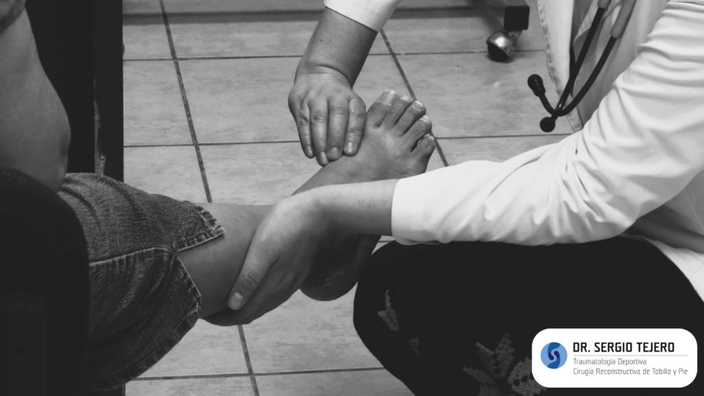 Pie paralítico: qué es, causas, síntomas y tratamiento
