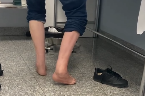 Paciente con enfermedad de Charcot-Marie-Tooth