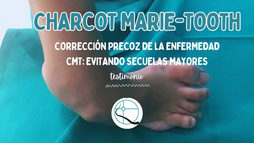 Testimonio paciente de Charcot-Marie-Tooth